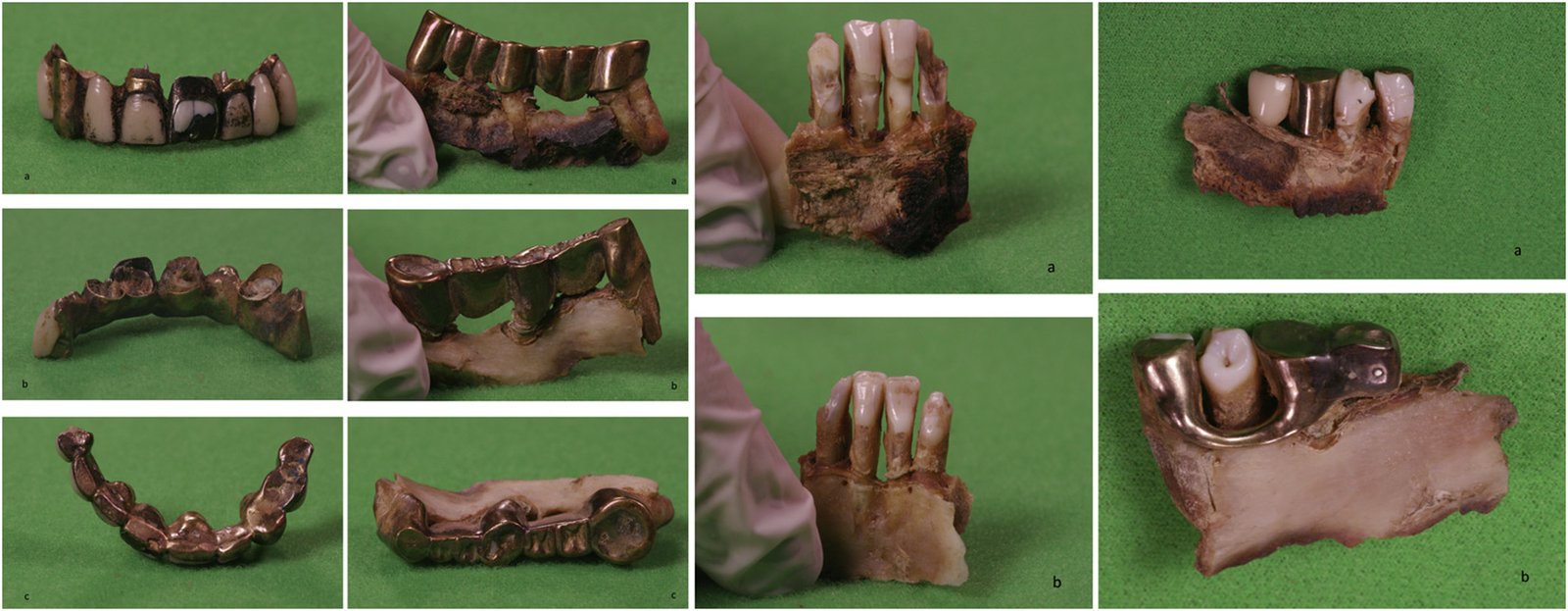 After the Bunker: What We Know, and Why It Matters